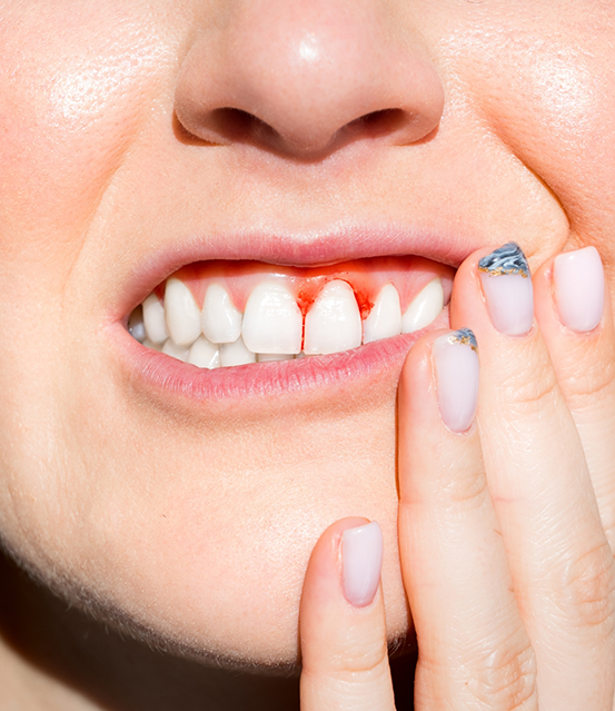 Close up of a person with a red spot in their gums
