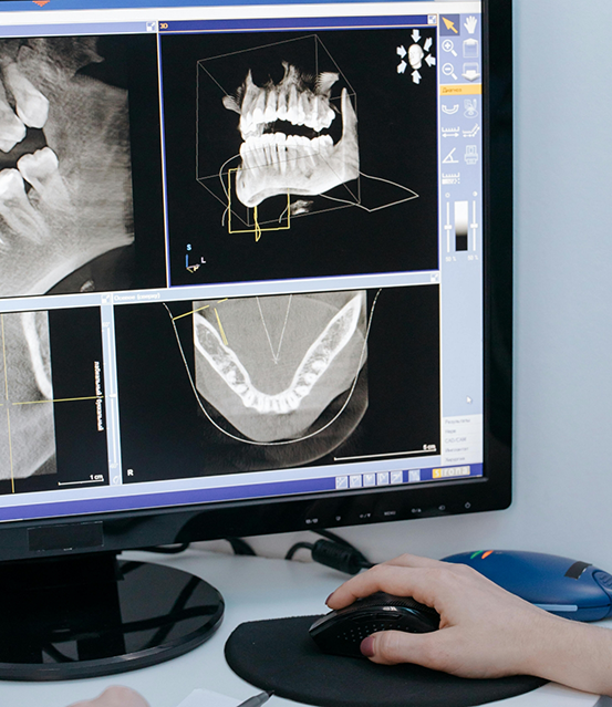 Computer screen showing x rays of a patient's teeth