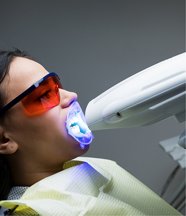 Dental patient getting professional teeth whitening