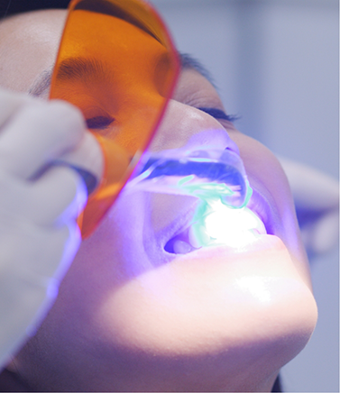 Dental patient getting an ultraviolet light shone onto their tooth