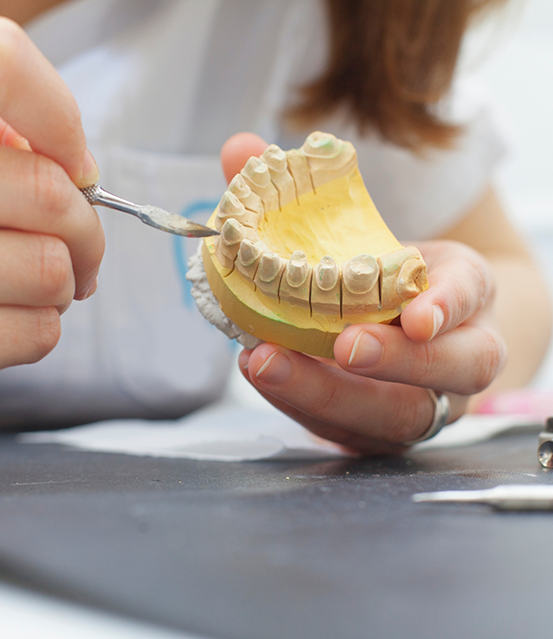 Dental professional crafting a bridge