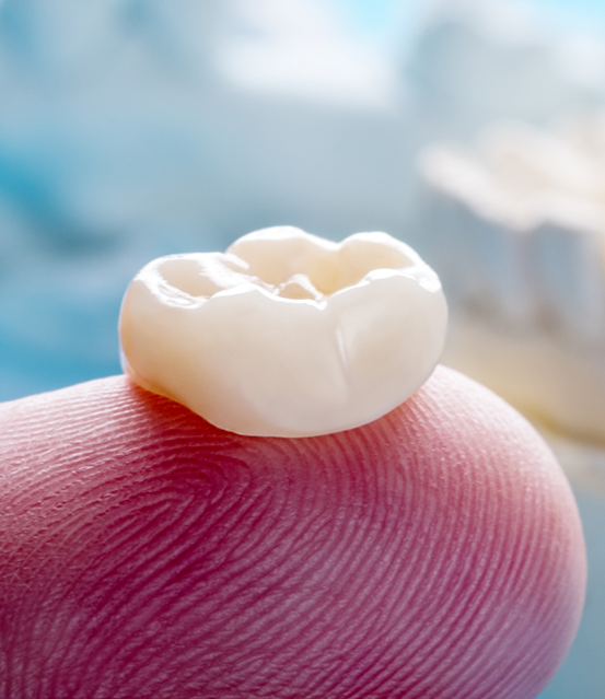 Dental crown resting on a finger