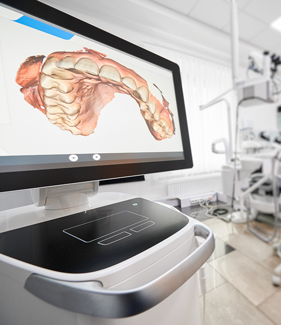 Impression of a row of teeth on a chairside monitor
