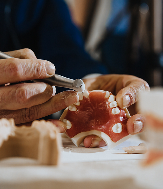 Dental professional creating a denture