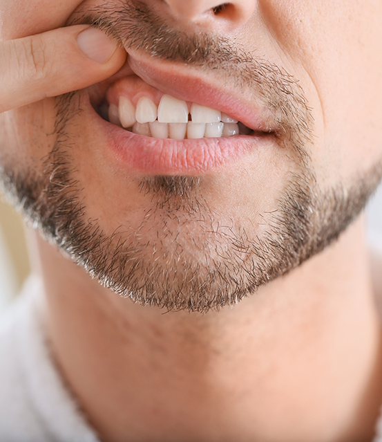 Man pointing to his gums