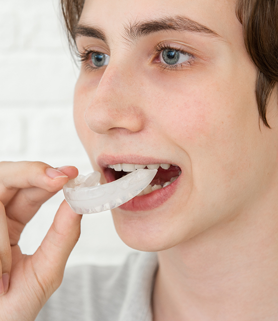 Person placing a nightguard over their teeth
