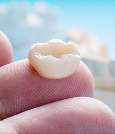 Dental crown resting on a person's finger