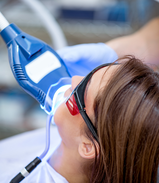 Dental patient getting professional teeth whitening