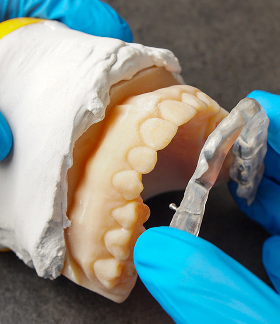 Dentist placing a clear tray over a model of the teeth