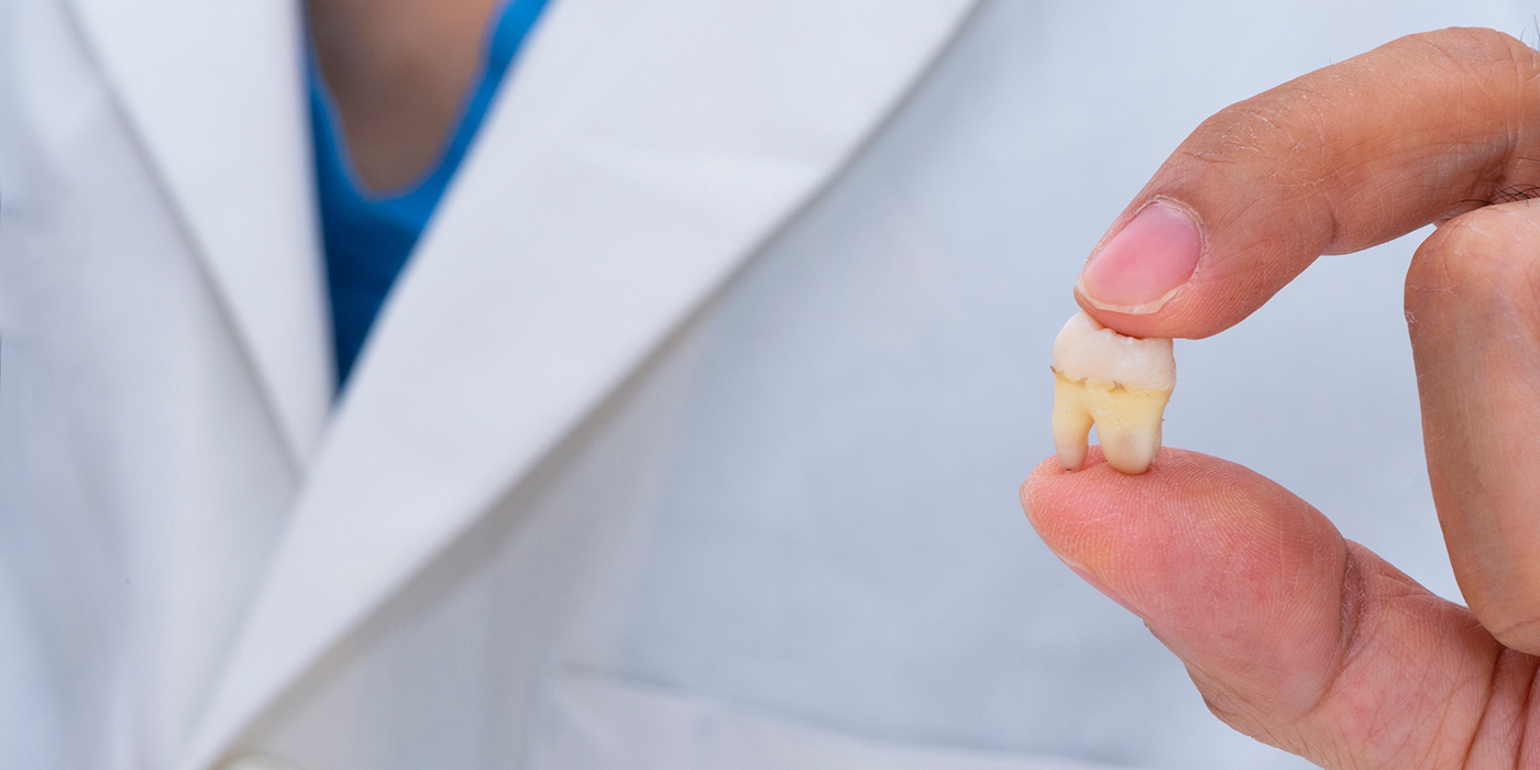 Dentist holding an extracted tooth